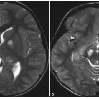 醫(yī)學(xué)進(jìn)展